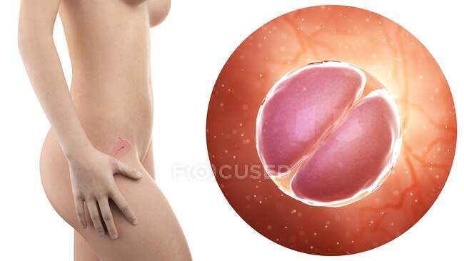 Illustrazione della silhouette della donna incinta con utero visibile ed embrione a 2 stadi cellulari
. — Foto stock