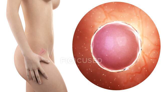 Ilustración de la silueta de la mujer embarazada con útero visible y óvulo fecundado . - foto de stock