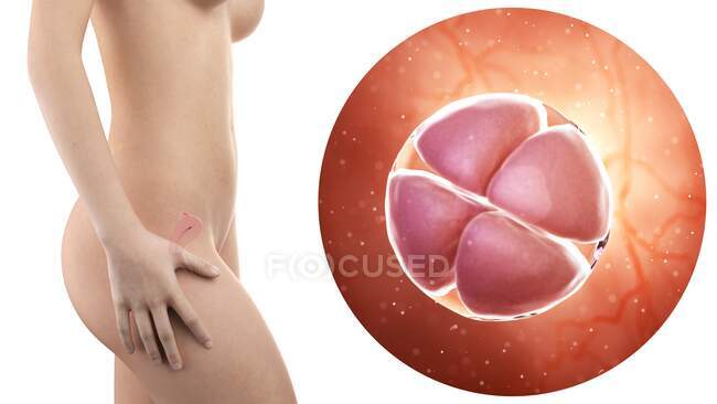 Ilustración de la silueta de la mujer embarazada con útero visible y embrión en estadio de 4 células . - foto de stock