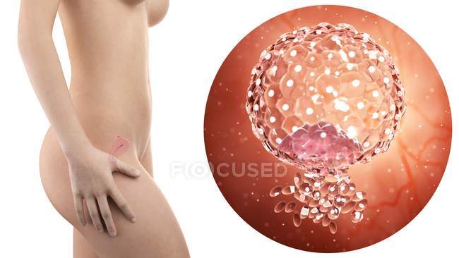 Illustration de la silhouette d'une femme enceinte avec utérus visible et blastocyste implanté . — Photo de stock