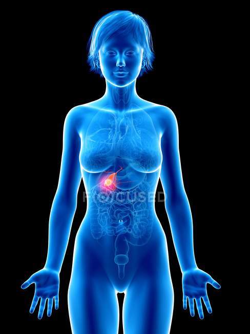 Medical illustration of gallbladder cancer in female silhouette. — Stock Photo