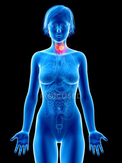 Ilustración médica del cáncer de glándula tiroides en la silueta femenina . - foto de stock