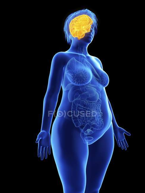 Illustration of blue silhouette of obese woman with highlighted brain on black background. — Stock Photo