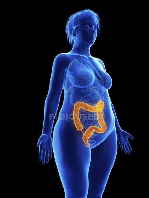 Illustration of blue silhouette of obese woman with highlighted colon on black background. — Stock Photo