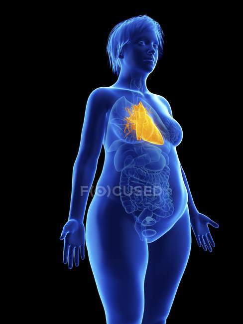 Illustration of blue silhouette of obese woman with highlighted heart on black background. — Stock Photo