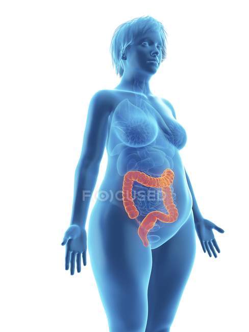 Illustration of blue silhouette of obese woman with highlighted colon on white background. — Stock Photo