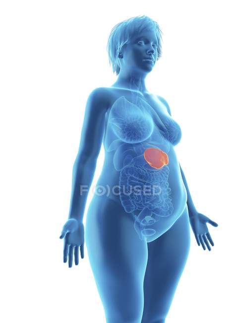 Ilustración de silueta azul de mujer obesa con bazo resaltado sobre fondo blanco . - foto de stock