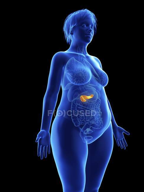 Ilustración de silueta azul de mujer obesa con páncreas resaltado sobre fondo negro . - foto de stock