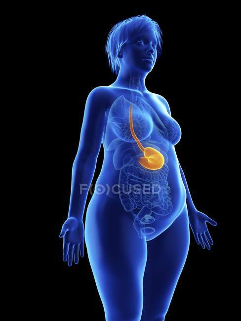 Ilustración de la silueta azul de la mujer obesa con el estómago resaltado sobre fondo negro . - foto de stock