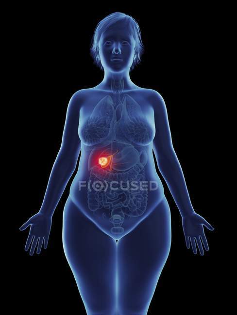Ilustración de tumor canceroso en la vesícula biliar femenina
. - foto de stock