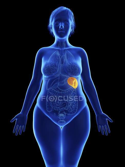 Frontal illustration of blue silhouette of obese woman with highlighted spleen on black background. — Stock Photo