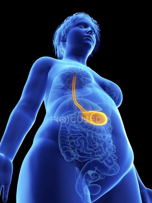 Low angle view illustration on black of silhouette of obese woman with highlighted stomach. — Stock Photo