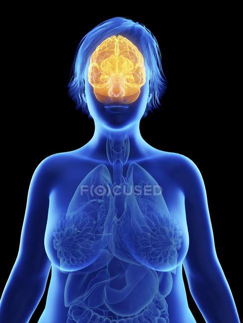 Illustration on black of silhouette of obese woman with highlighted brain. — Stock Photo