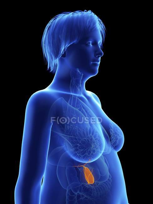 Abbildung auf Schwarz der Silhouette einer fettleibigen Frau mit hervorgehobener Gallenblase. — Stockfoto