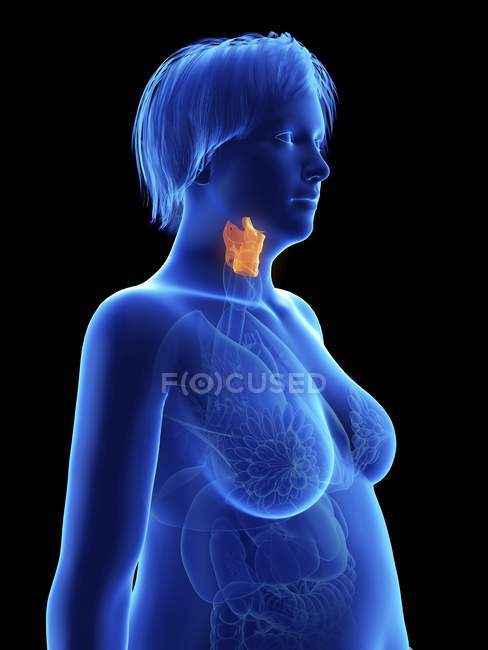 Illustration on black of silhouette of obese woman with highlighted larynx. — Stock Photo