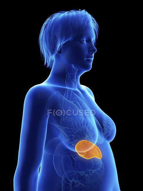 Illustration on black of silhouette of obese woman with highlighted spleen. — Stock Photo