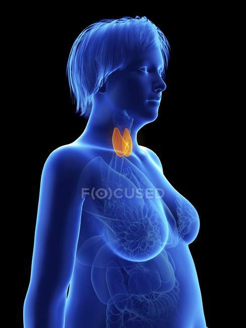 Illustrazione su nero di silhouette di donna obesa con ghiandola tiroidea evidenziata . — Foto stock