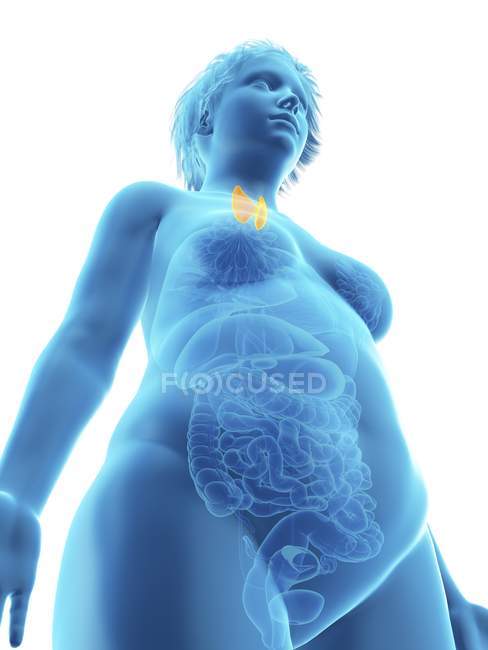 Basso angolo di visualizzazione illustrazione della silhouette blu della donna obesa con evidenziata ghiandola tiroidea . — Foto stock