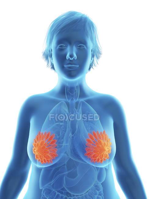 Illustration der blauen Silhouette einer fettleibigen Frau mit hervorgehobenen Brustdrüsen. — Stockfoto