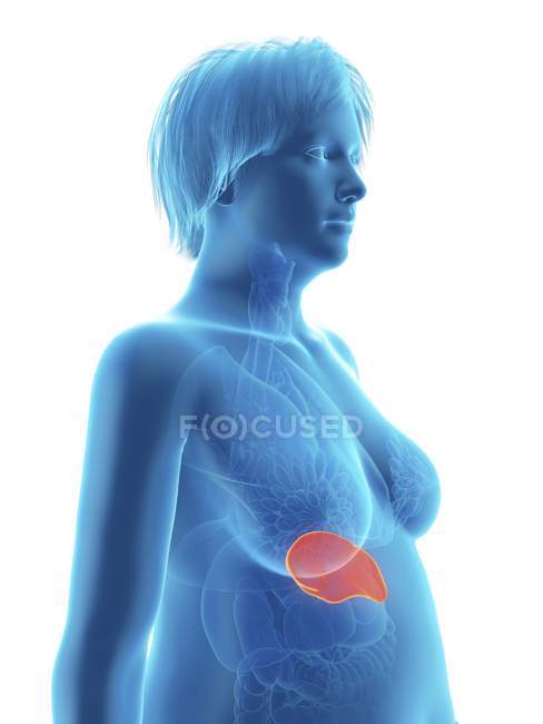 Ilustración de silueta azul de mujer obesa con bazo resaltado . - foto de stock