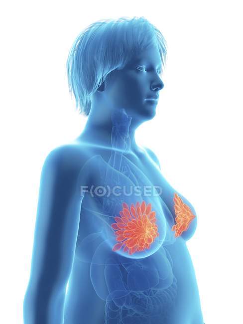 Ілюстрація синього силуету ожиріння жінки з підсвіченими молочними залозами . — стокове фото