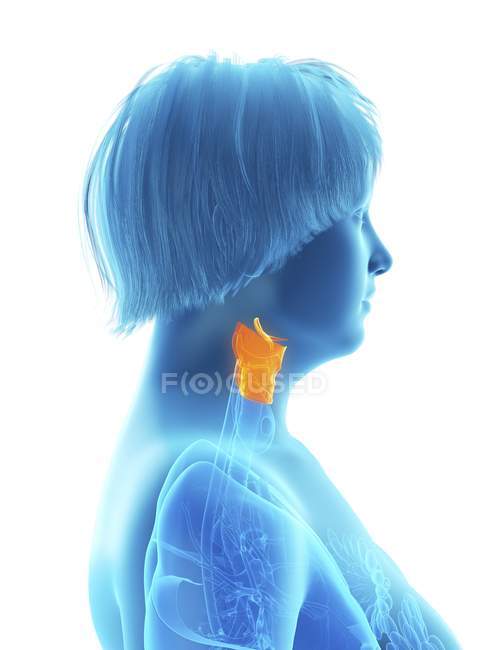 Ilustración vista lateral de silueta azul de mujer obesa con laringe resaltada . - foto de stock