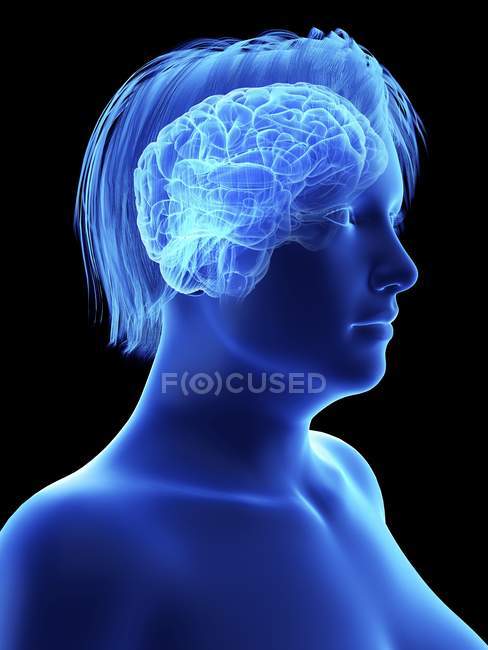 Illustration der blauen Silhouette einer fettleibigen Frau mit hervorgehobenem Gehirn. — Stockfoto