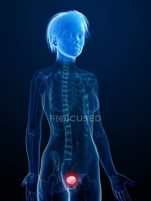 Ilustración de la silueta humana con la vejiga inflamada . - foto de stock
