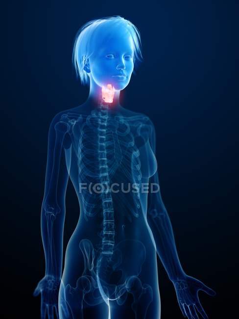 Illustration de la silhouette humaine avec larynx enflammé . — Photo de stock