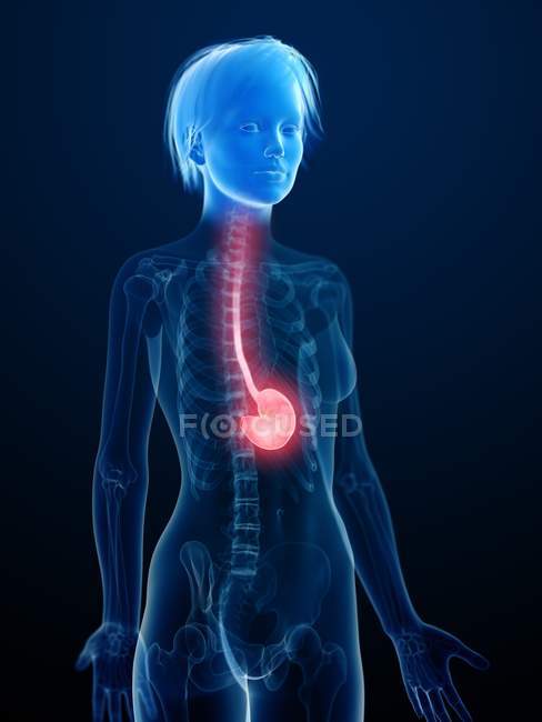Illustration of human silhouette with inflamed stomach. — Stock Photo