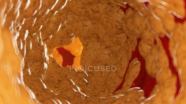Illustration de graisse à l'intérieur de l'artère humaine
. — Photo de stock