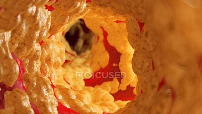 Медицинская иллюстрация жира внутри человеческой артерии
. — стоковое фото