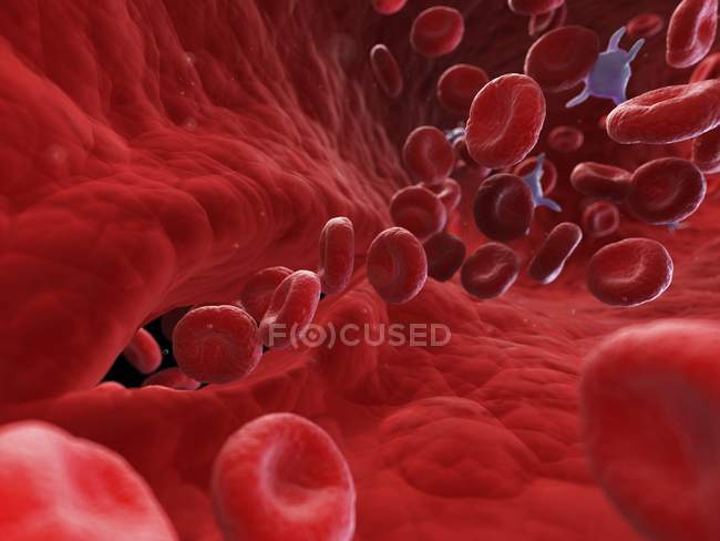 Ilustración de células sanguíneas en arteria lesionada . - foto de stock