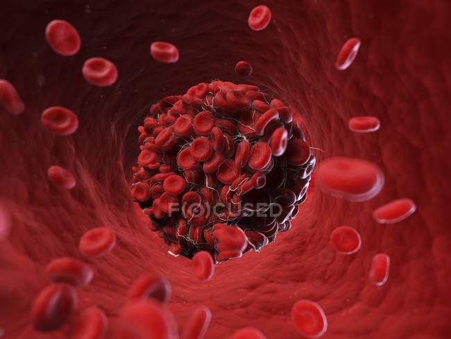 Illustration du groupe de cellules dans le caillot sanguin . — Photo de stock