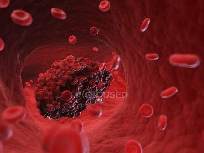 Illustration der Gruppe von Zellen im Blutgerinnsel. — Stockfoto