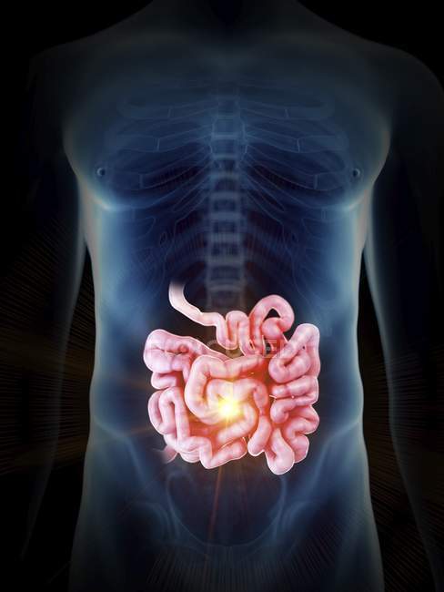 Illustration of human silhouette with painful small intestine. — Stock Photo