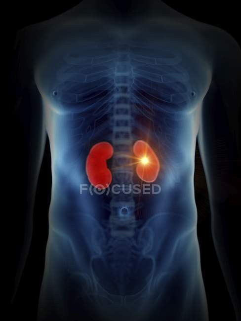 Illustration of human silhouette with painful kidney. — Stock Photo