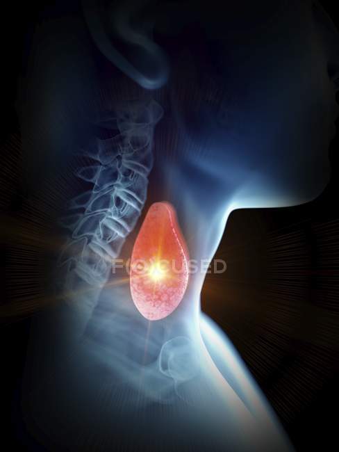 Ilustración de la silueta humana con glándula tiroides dolorosa . - foto de stock