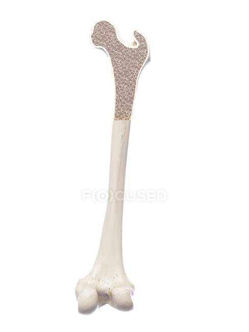 Illustration de l'ostéoporose osseuse sur fond blanc . — Photo de stock