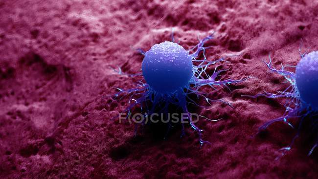 Farbige digitale Abbildung der Krebszelle. — Stockfoto