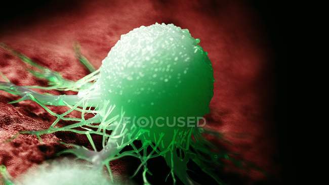 Colored digital illustration of green cancer cell. — Stock Photo