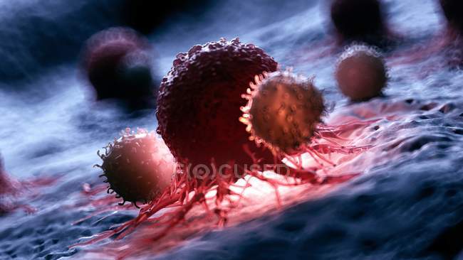 Création numérique de globules blancs attaquant les cellules cancéreuses rouges illuminées
. — Photo de stock