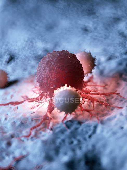 Ilustración coloreada de células cancerosas atacadas por glóbulos blancos
. - foto de stock