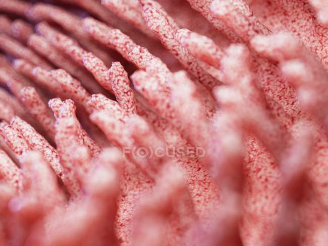 Illustrazione medica di villi intestinali infiammati . — Foto stock