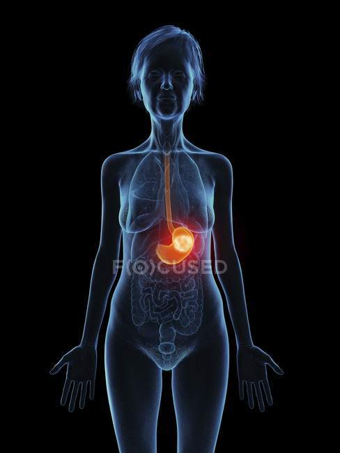 Illustration de la silhouette d'une femme âgée montrant une tumeur à l'estomac
. — Photo de stock