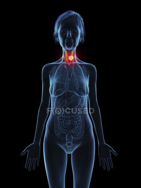 Ilustración de la silueta de mujer mayor que muestra el tumor de la glándula tiroides . - foto de stock