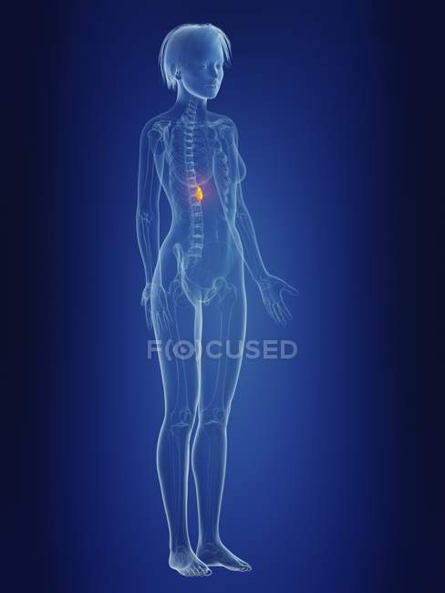 Ilustración de silueta femenina con vesícula biliar dolorosa . - foto de stock
