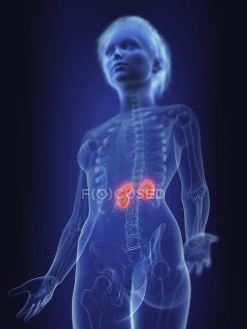 Illustrazione dei reni infiammati nella silhouette del corpo umano . — Foto stock