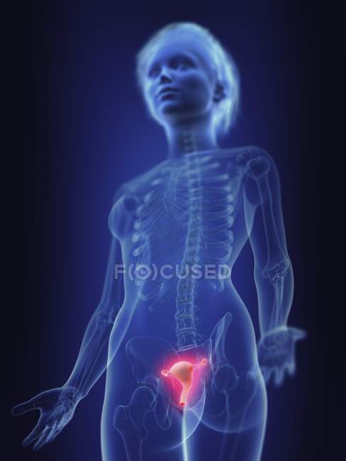 Illustrazione della silhouette umana con utero infiammato . — Foto stock