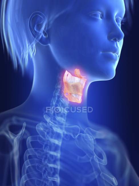 Illustration of human silhouette with inflamed larynx. — Stock Photo